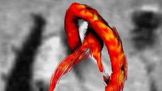 EinBlicke: Biomedizin und Bildgebung (Foto: Bovenkamp et al)