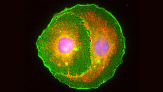 EinBlicke: Biomedizin und Bildgebung (Foto: Bovenkamp et al)